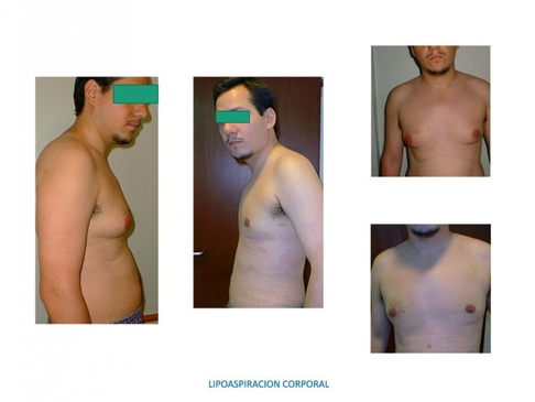 Slider image (6) ProEsthetik